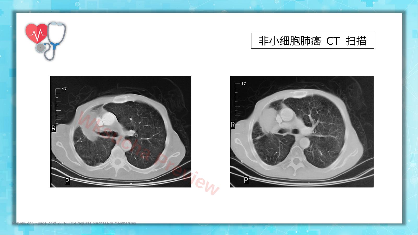 预览第 27 页