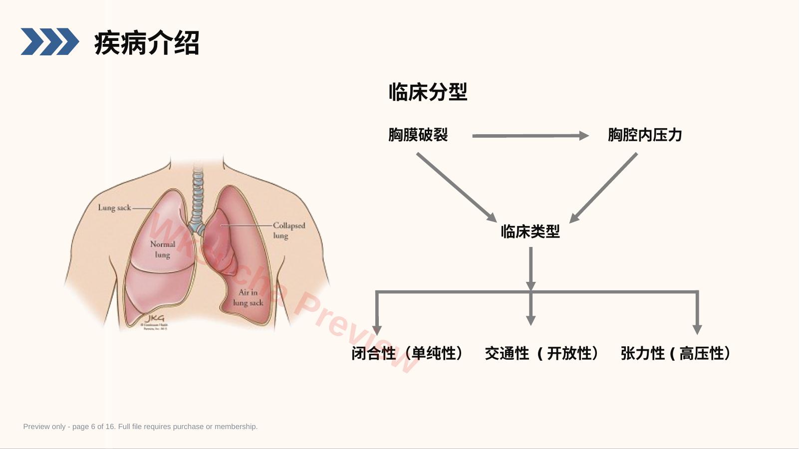 预览第 6 页