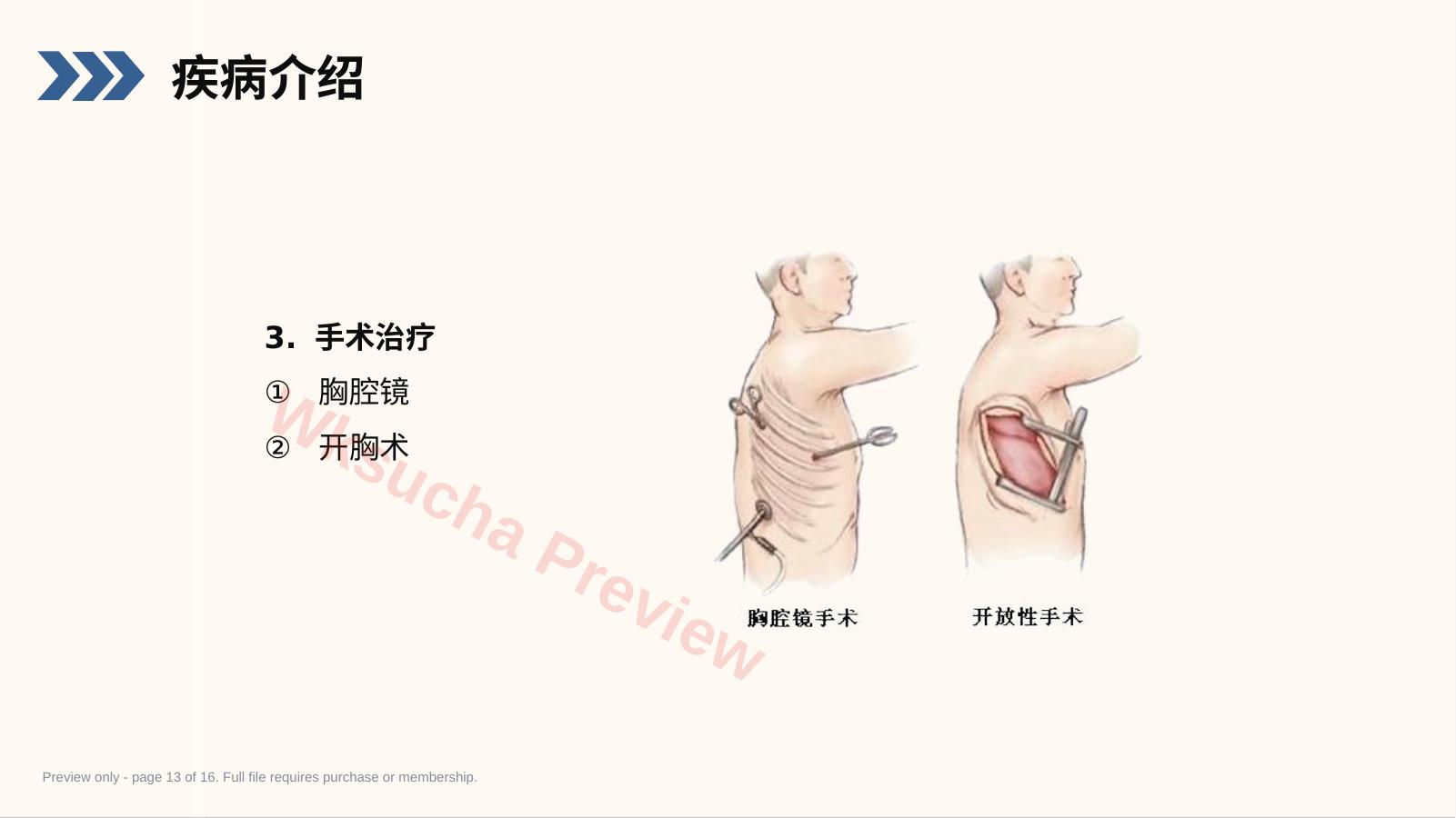 预览第 13 页