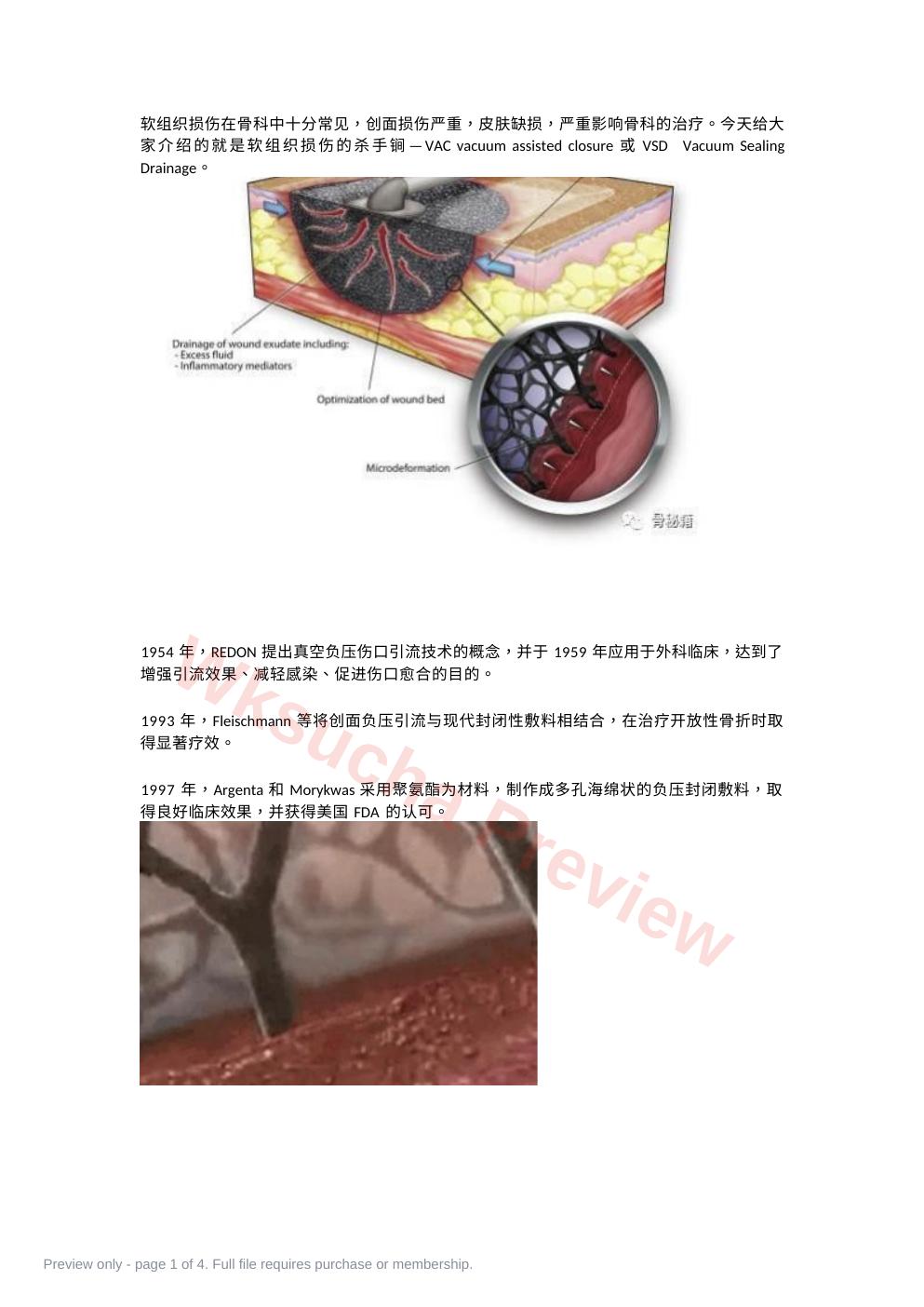 负压封闭引流技术治疗软组织损伤