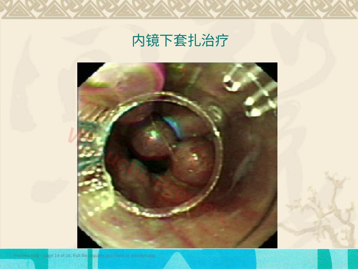 预览第 14 页