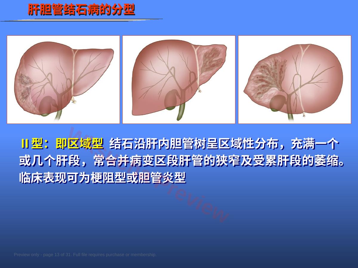 预览第 13 页