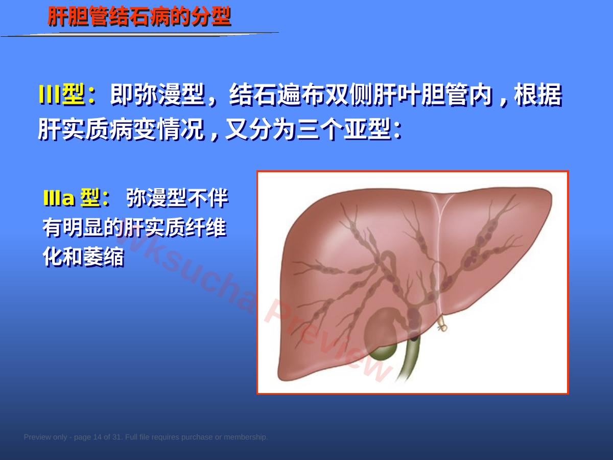预览第 14 页