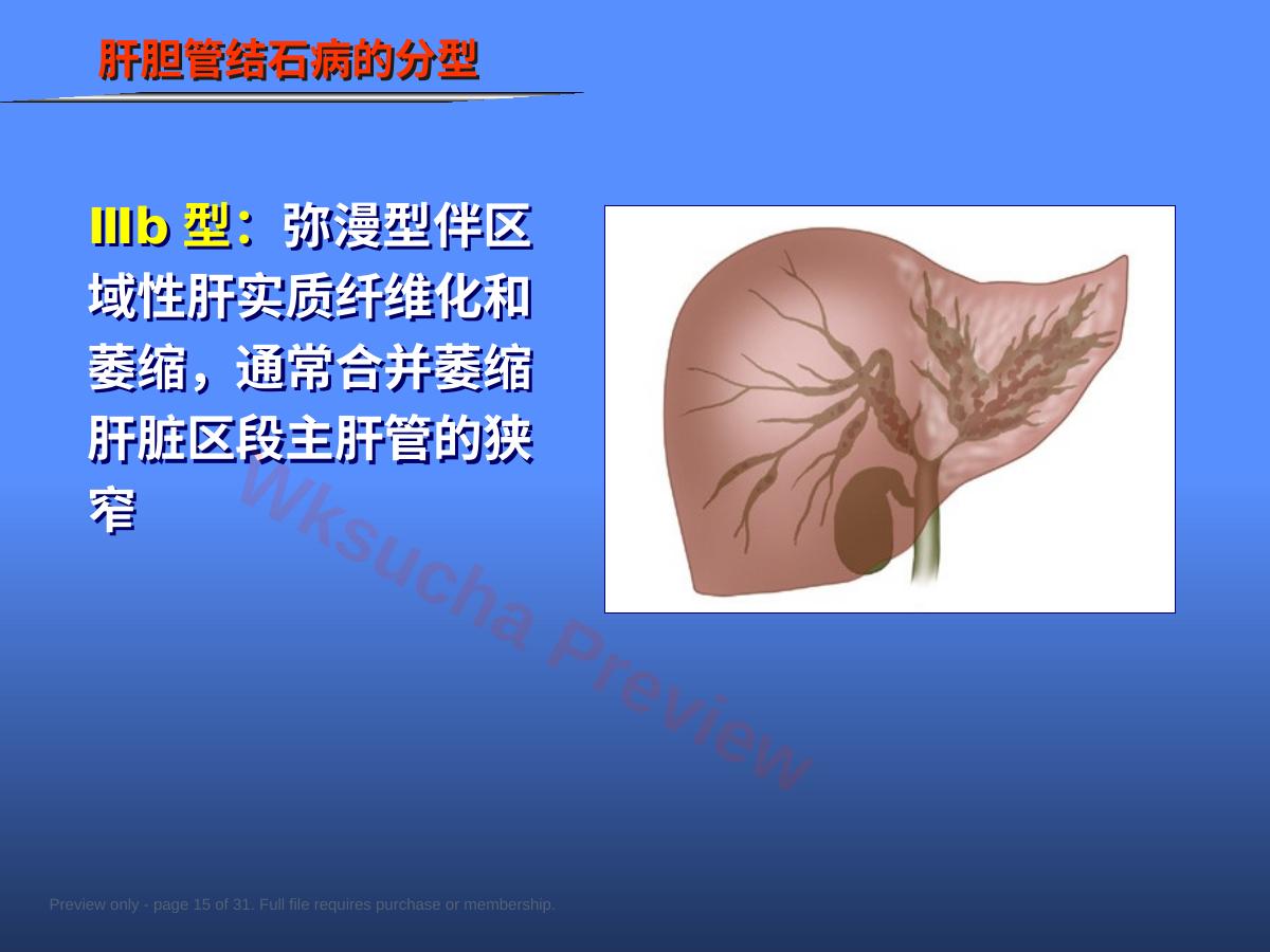 预览第 15 页