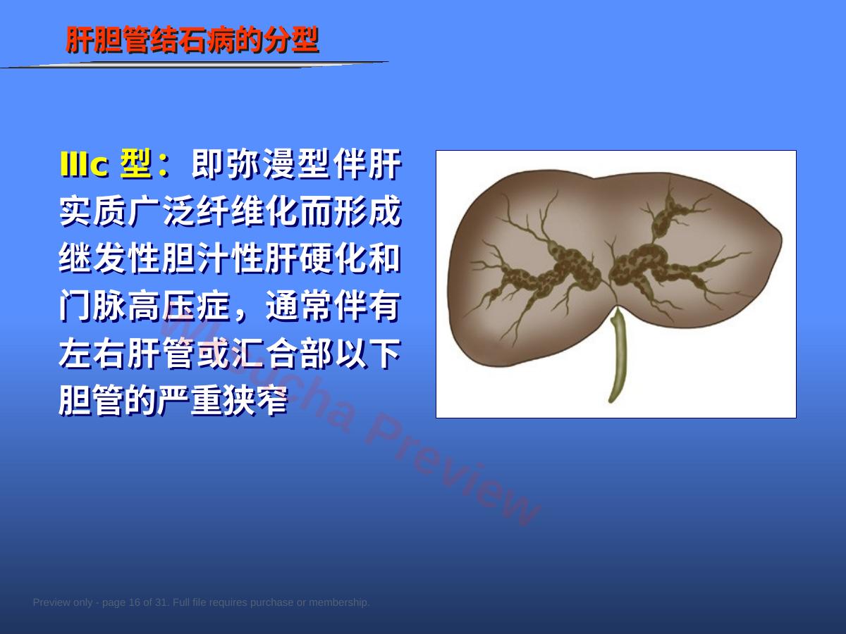 预览第 16 页