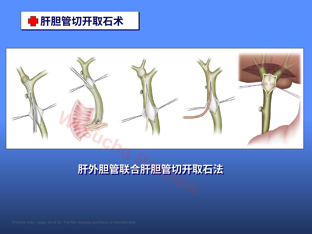 预览第 24 页