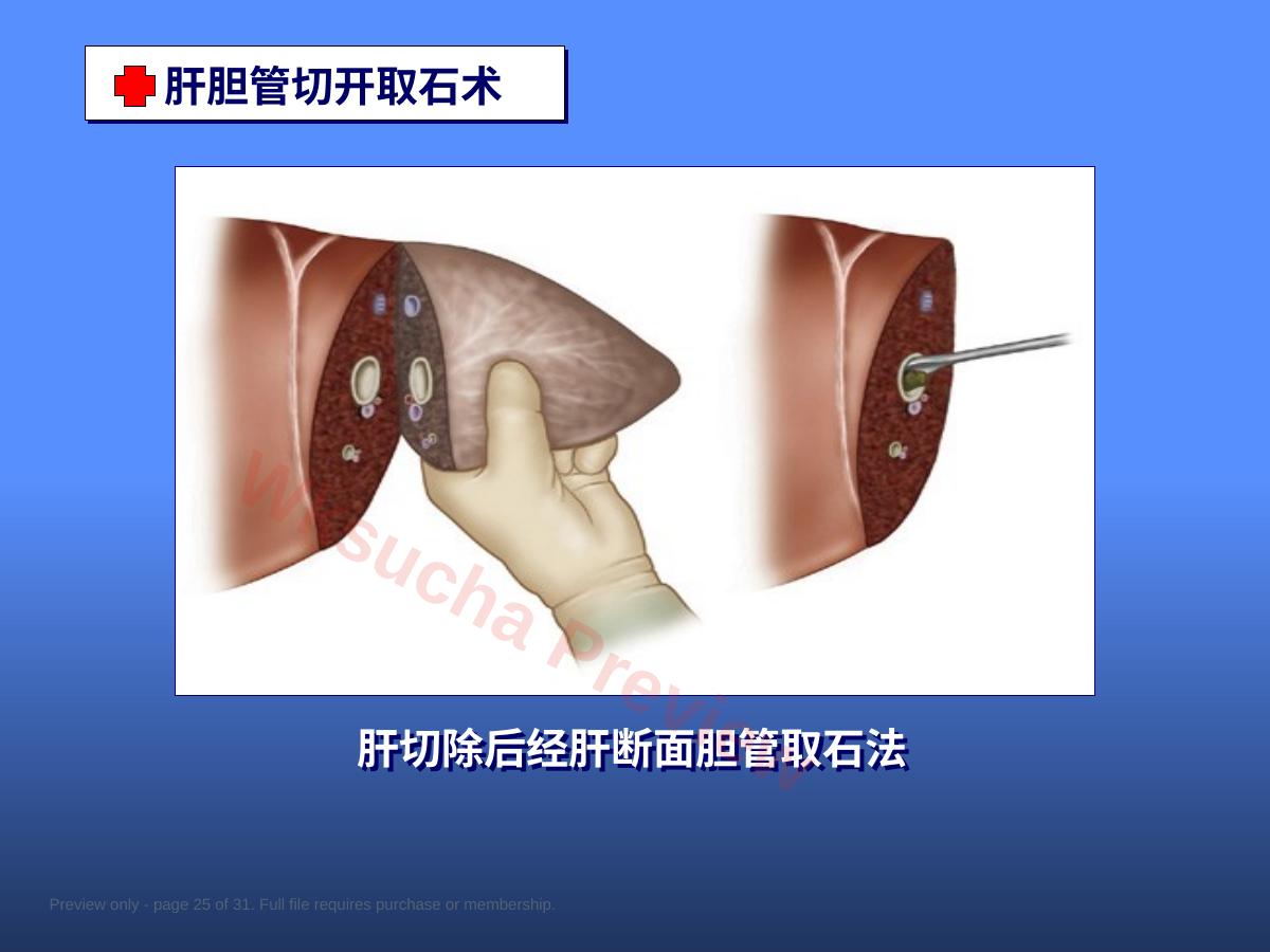 预览第 25 页