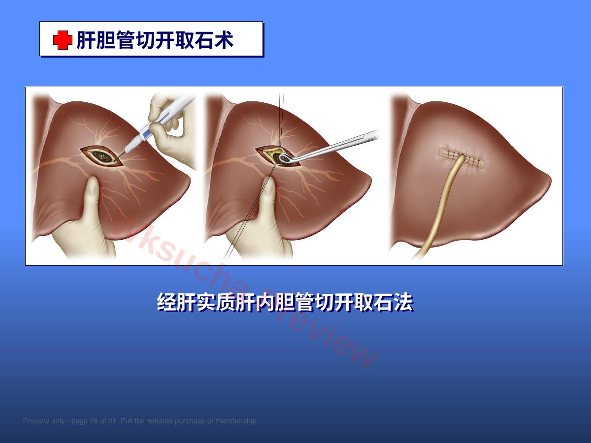 预览第 26 页
