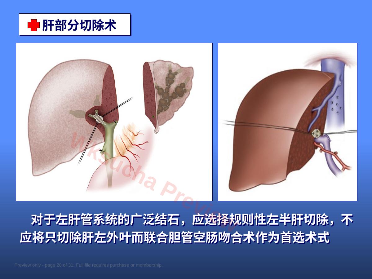 预览第 28 页