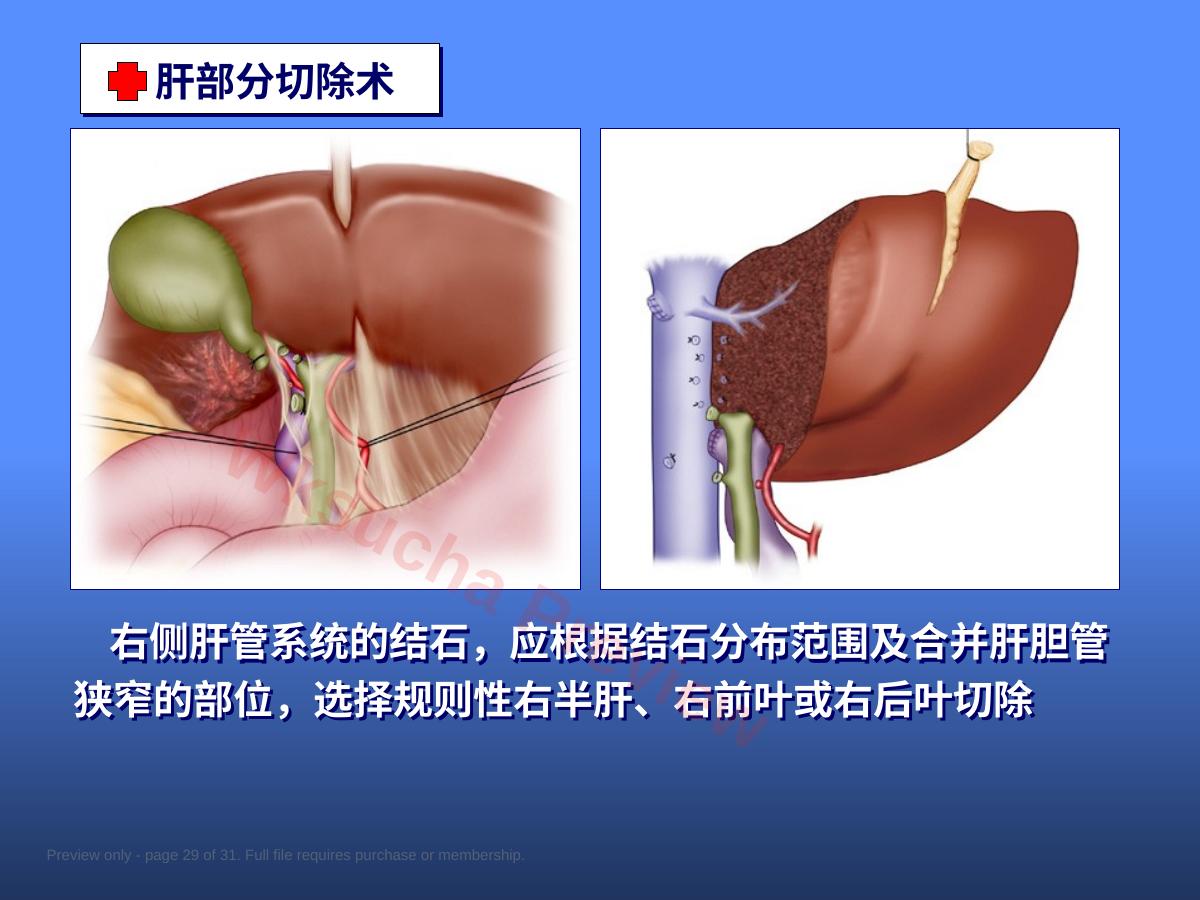 预览第 29 页