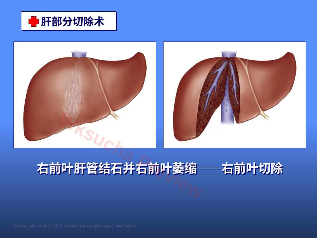 预览第 30 页