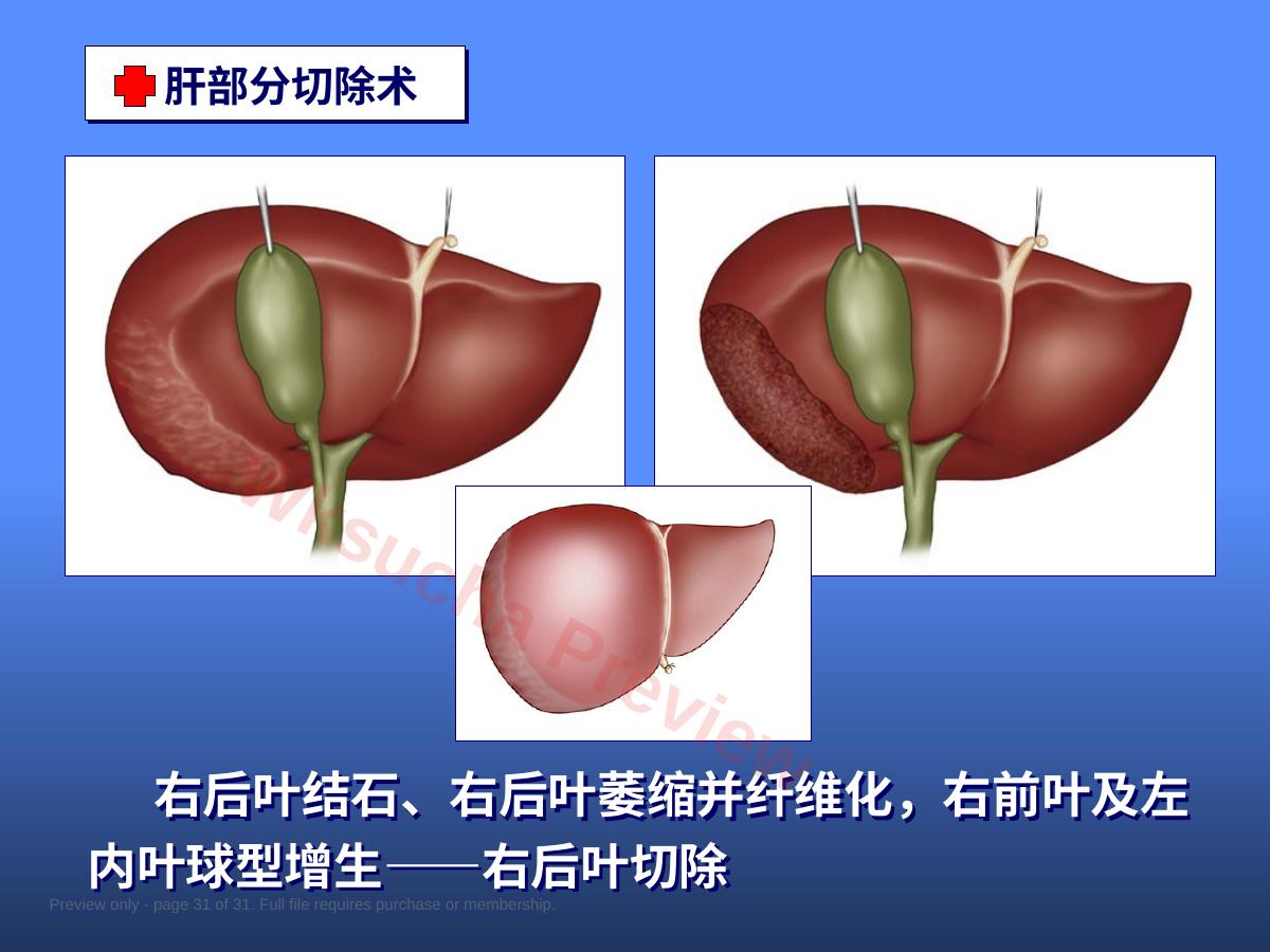 预览第 31 页