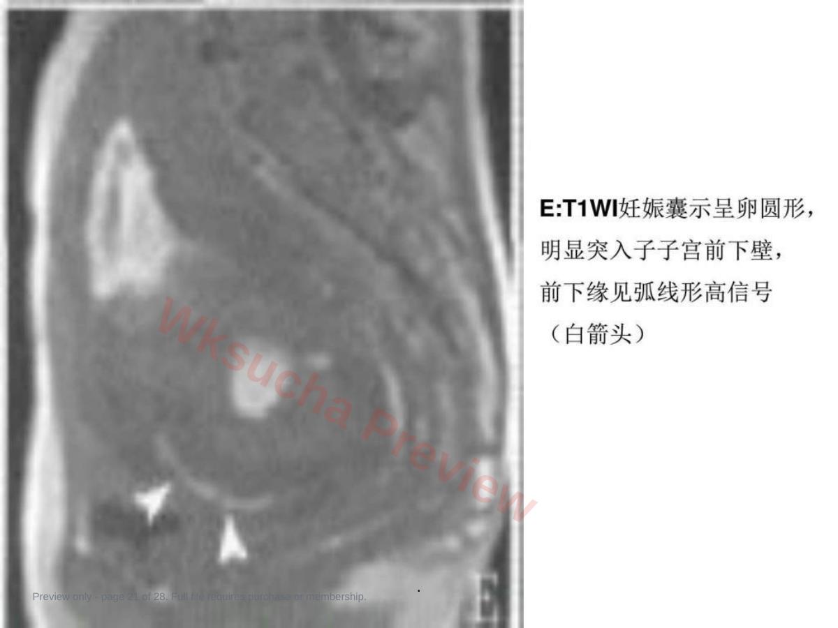预览第 21 页