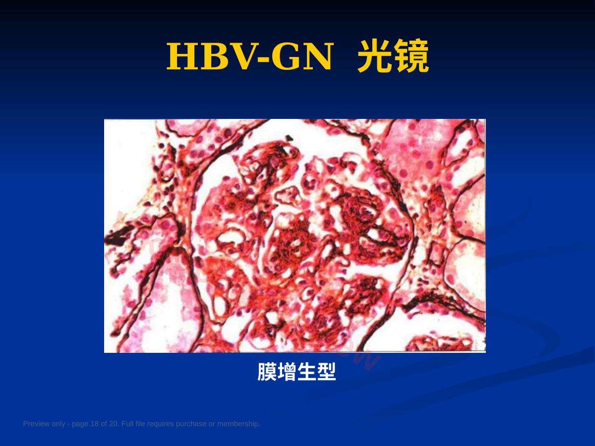 预览第 18 页