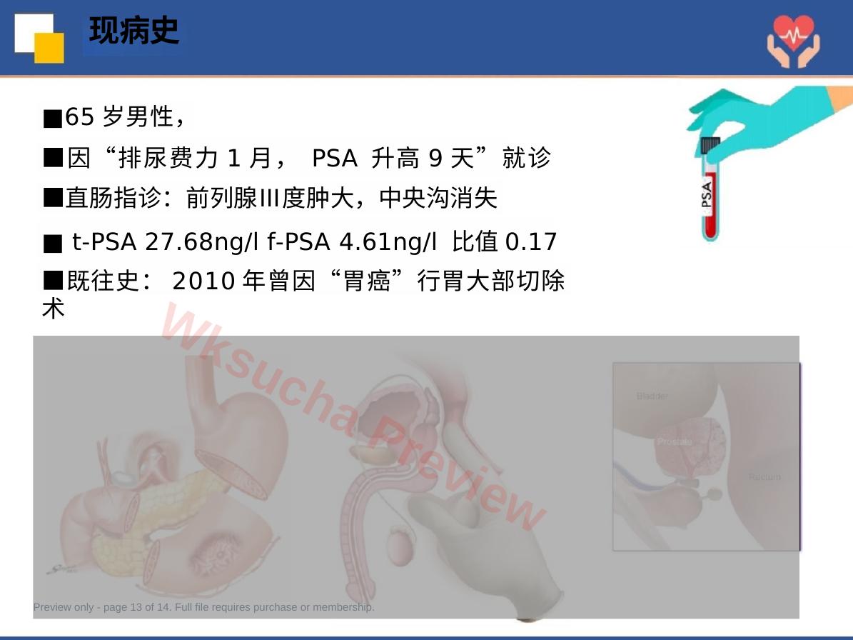 预览第 13 页