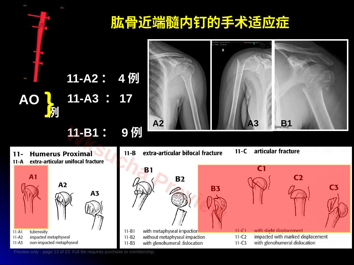 预览第 13 页