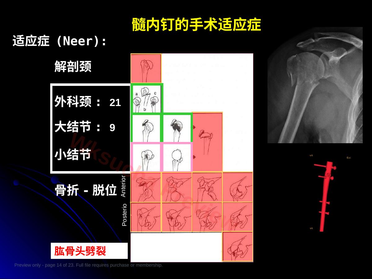 预览第 14 页