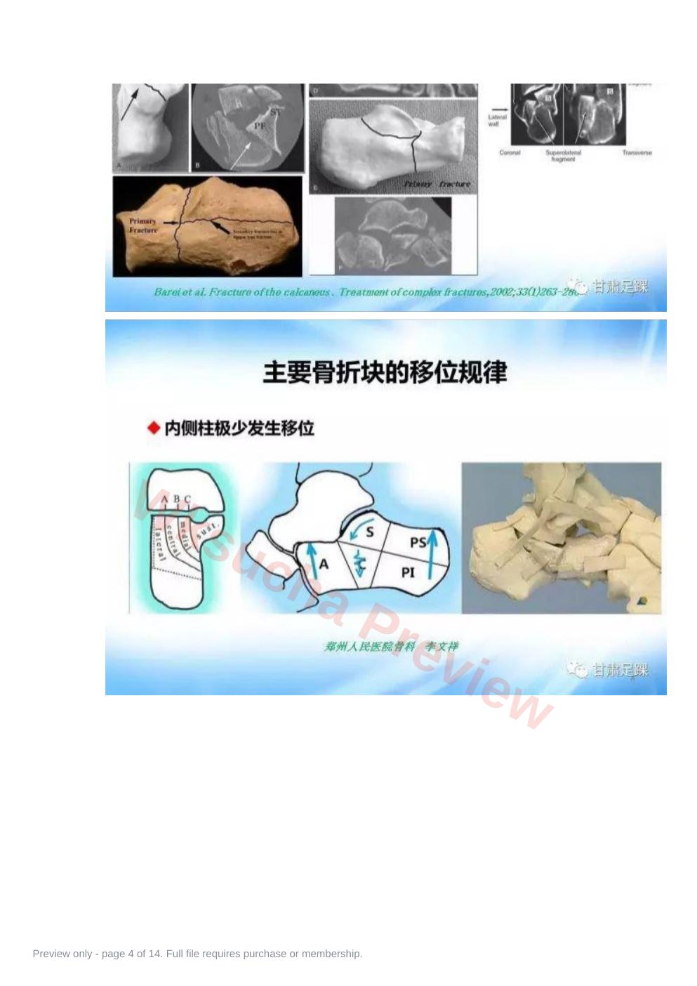 预览第 4 页