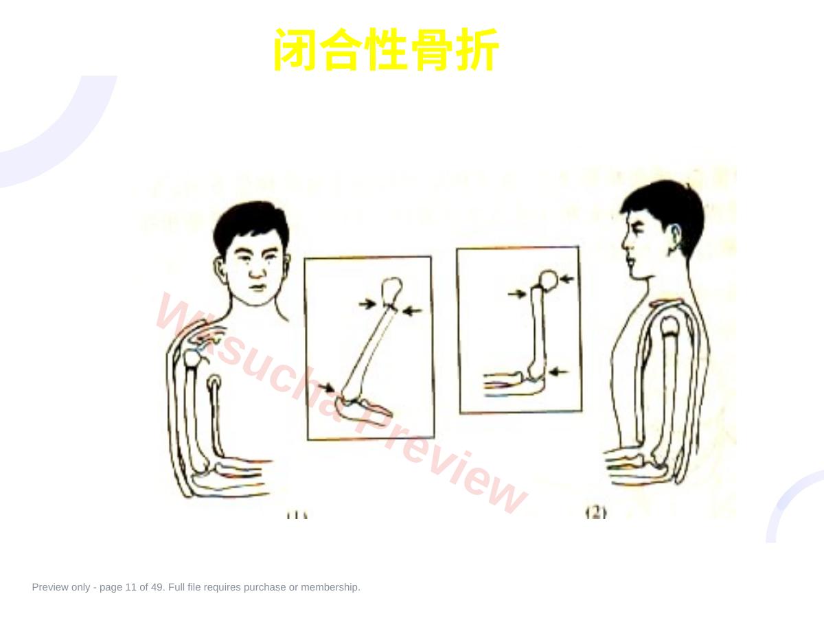预览第 11 页
