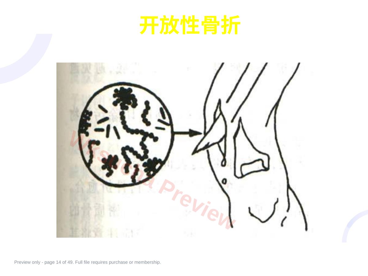 预览第 14 页