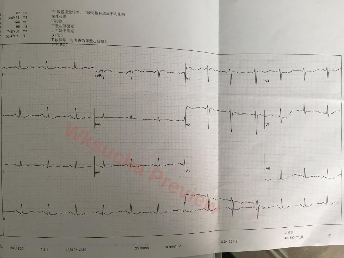 预览第 15 页