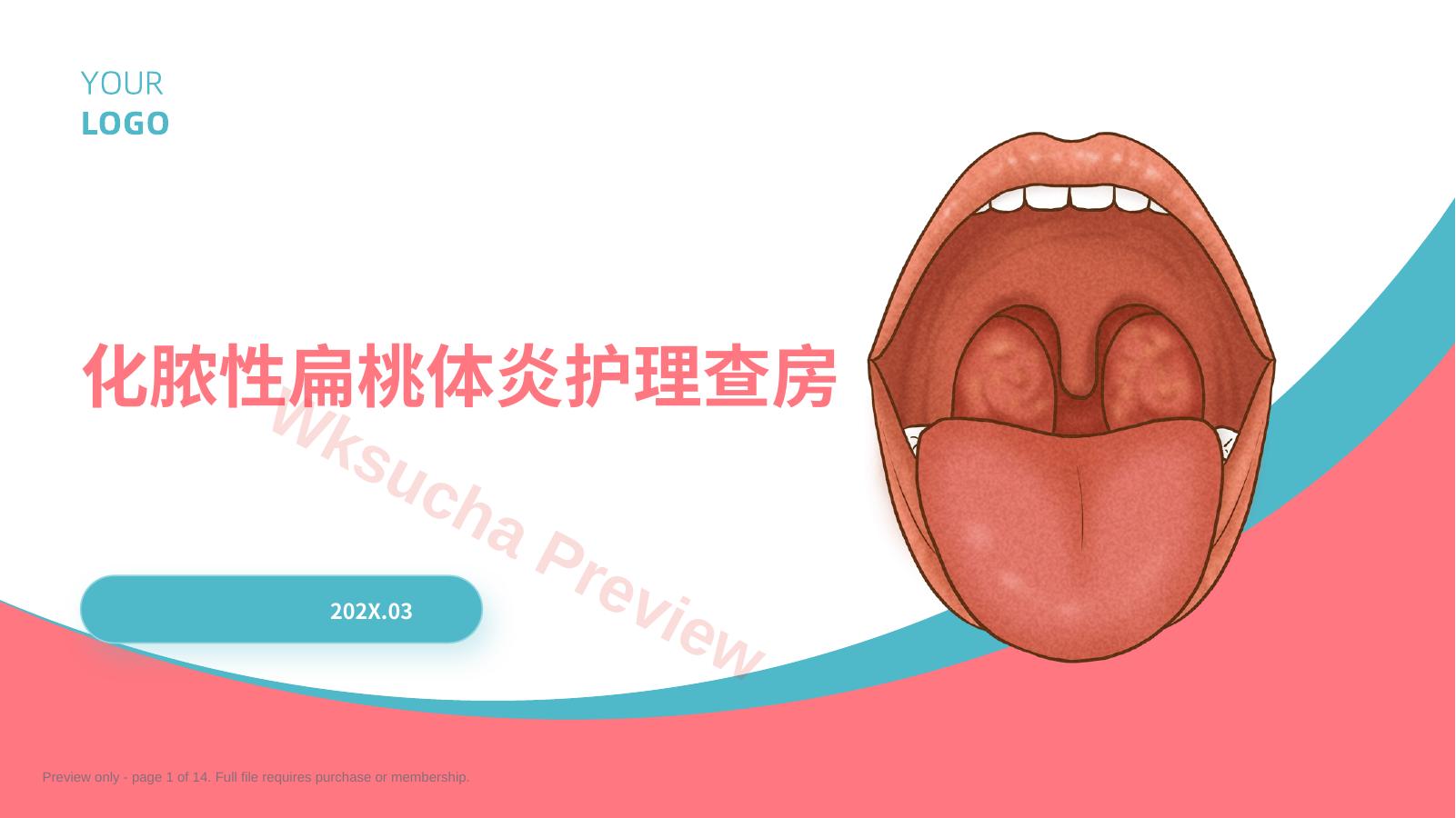 化脓性扁桃体炎护理查房带参考文献