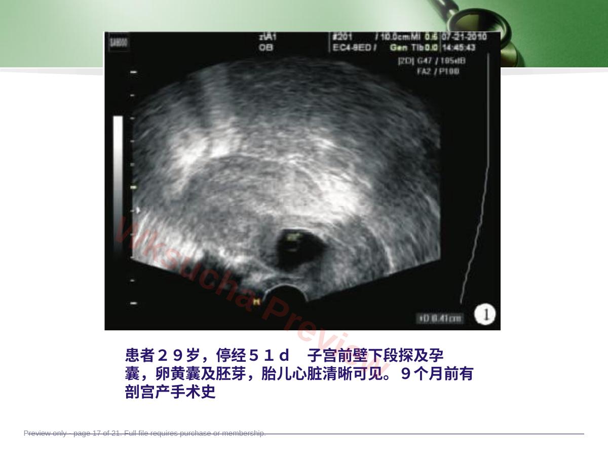 预览第 17 页