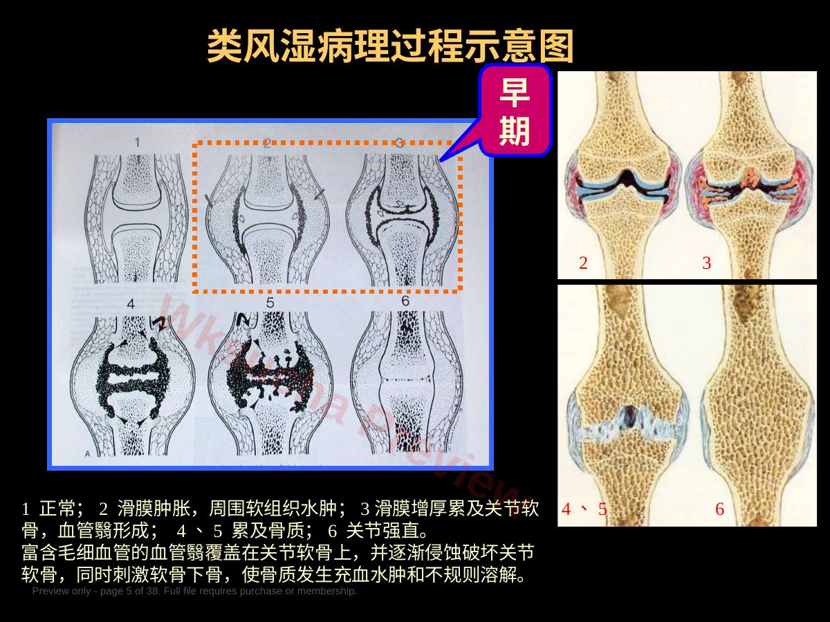 预览第 5 页
