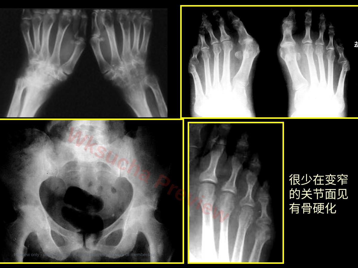 预览第 16 页