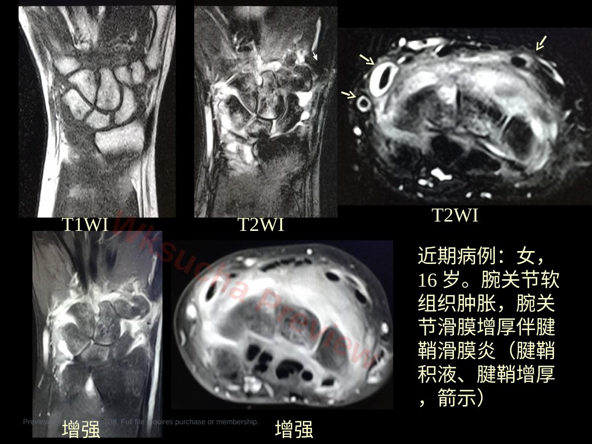 预览第 32 页