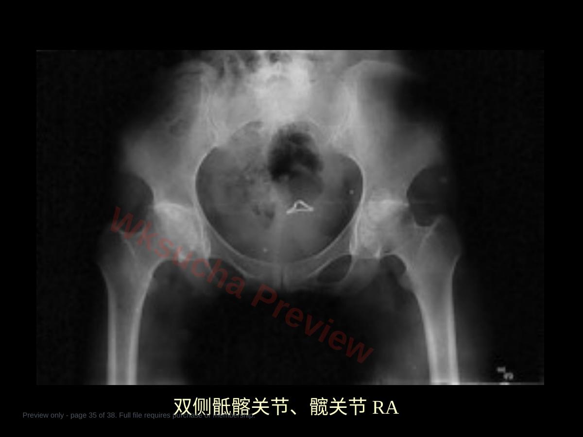 预览第 35 页