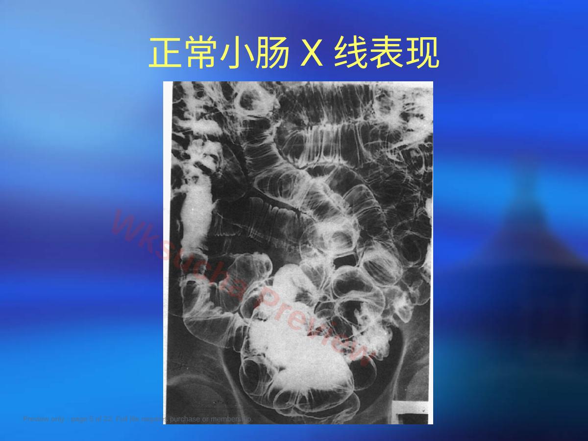 预览第 5 页