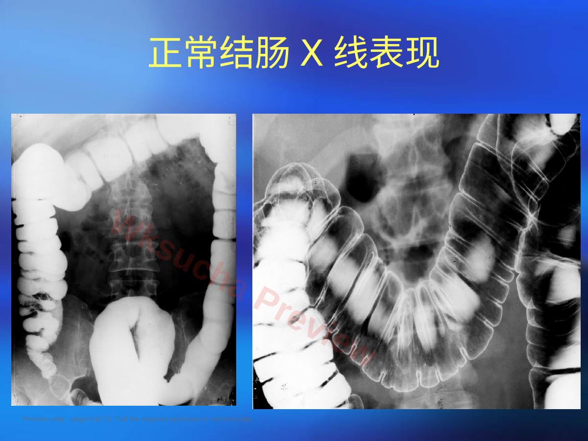预览第 6 页