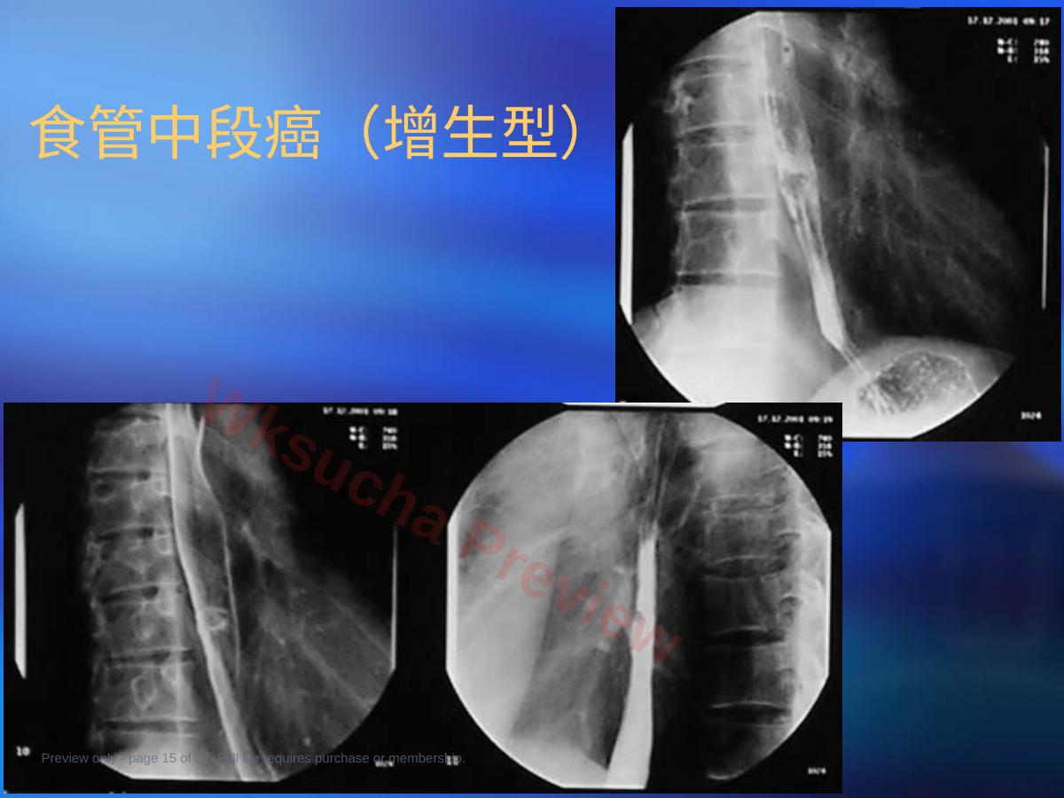 预览第 15 页