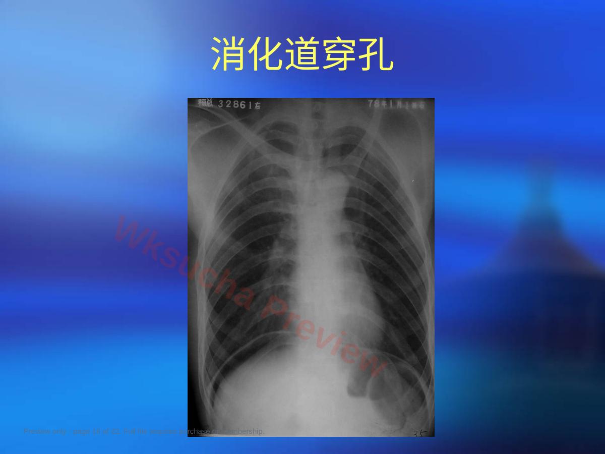 预览第 18 页