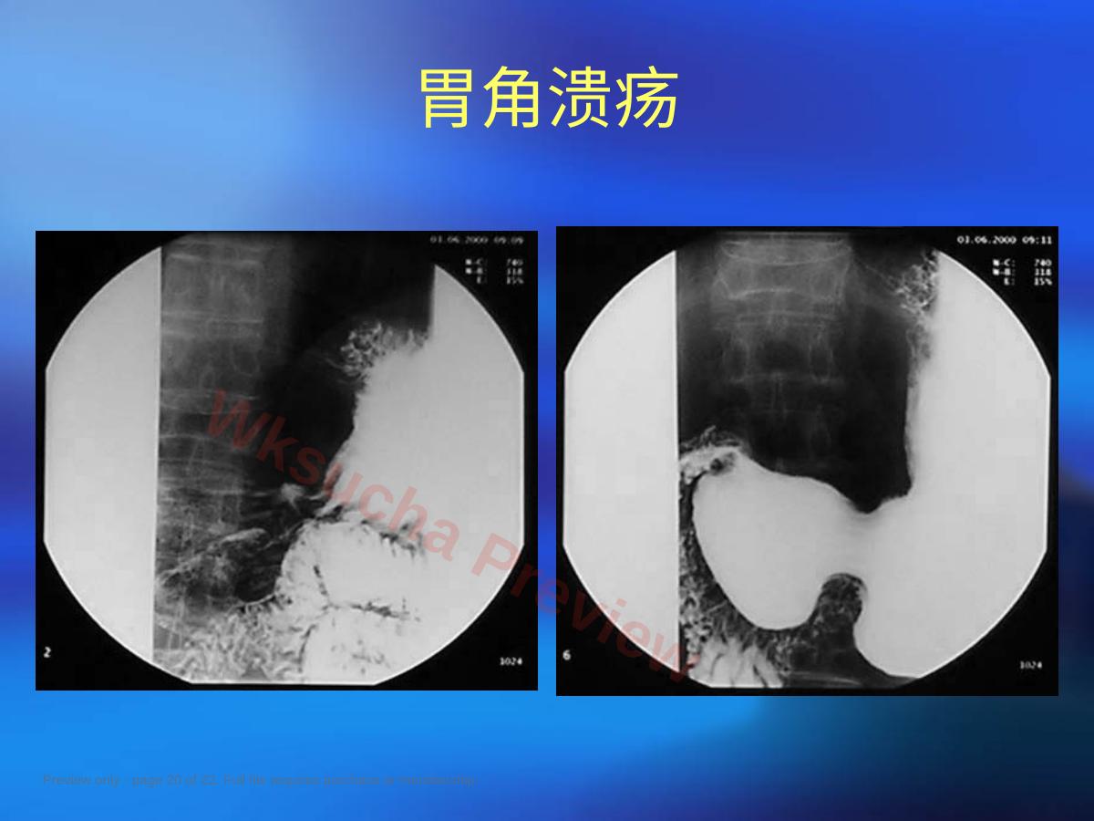 预览第 20 页