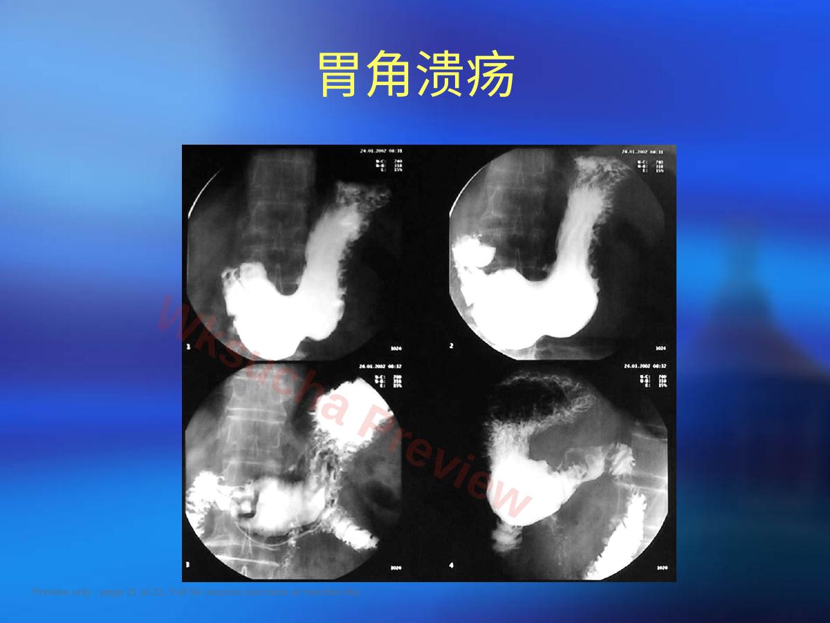 预览第 21 页