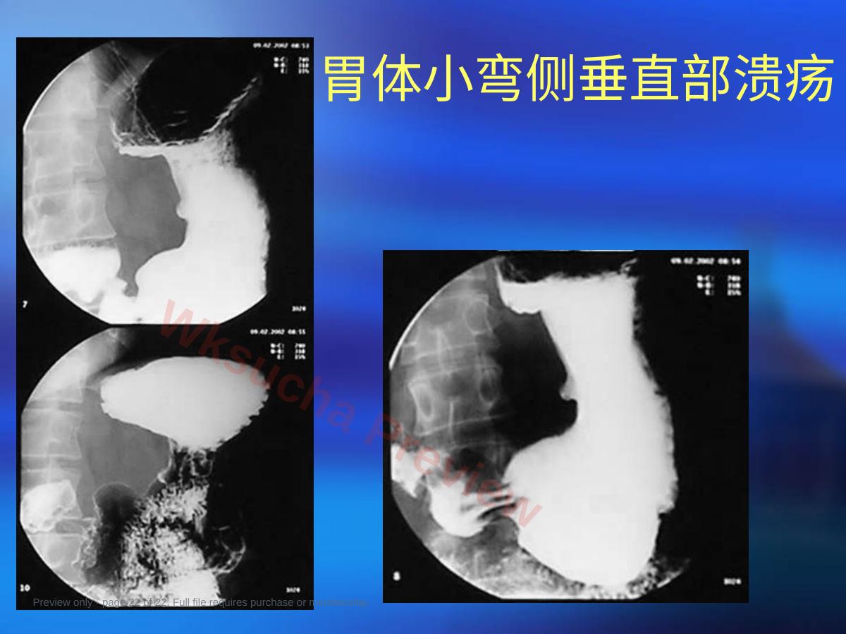 预览第 22 页