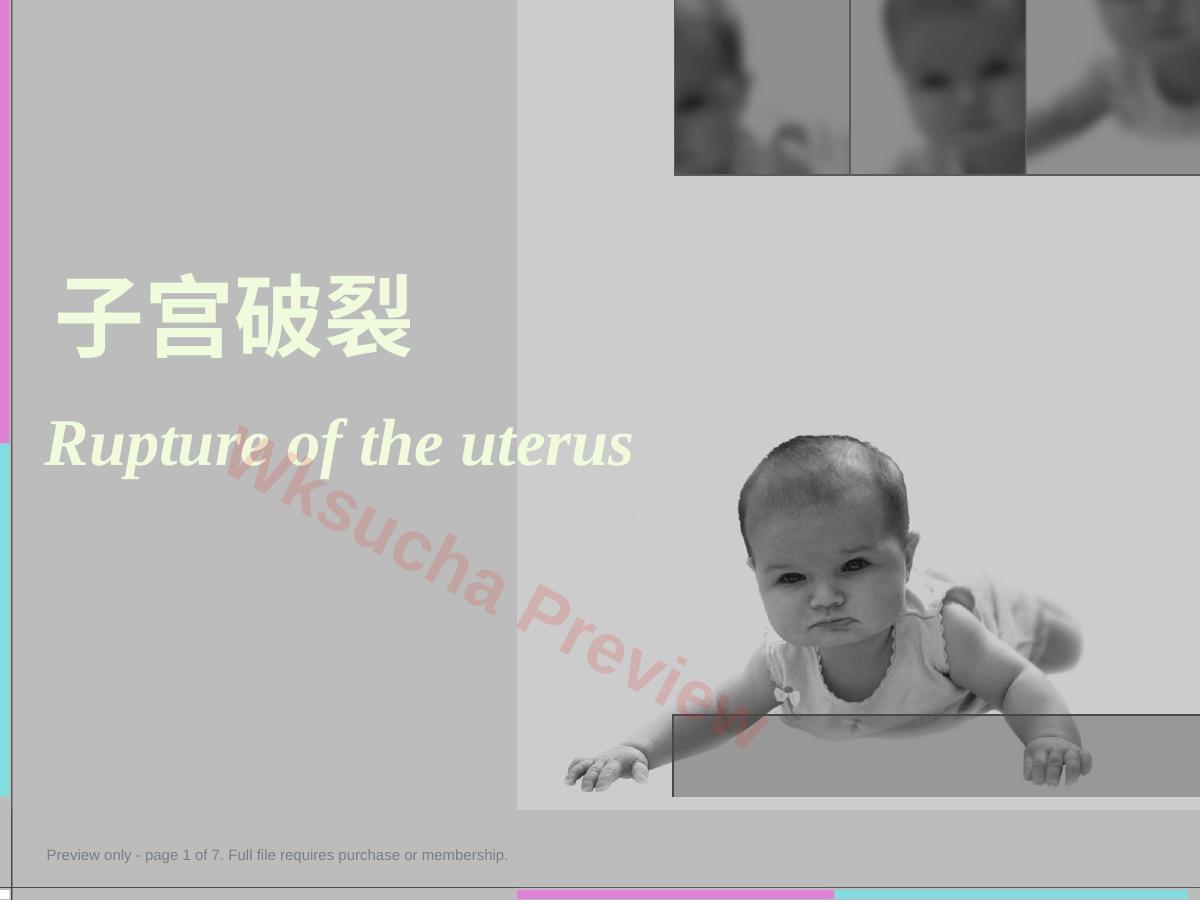 妇产科学 子宫破裂