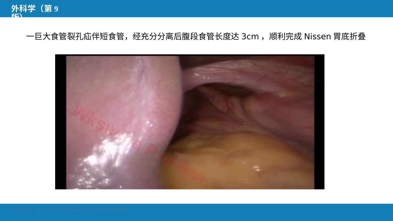 预览第 13 页