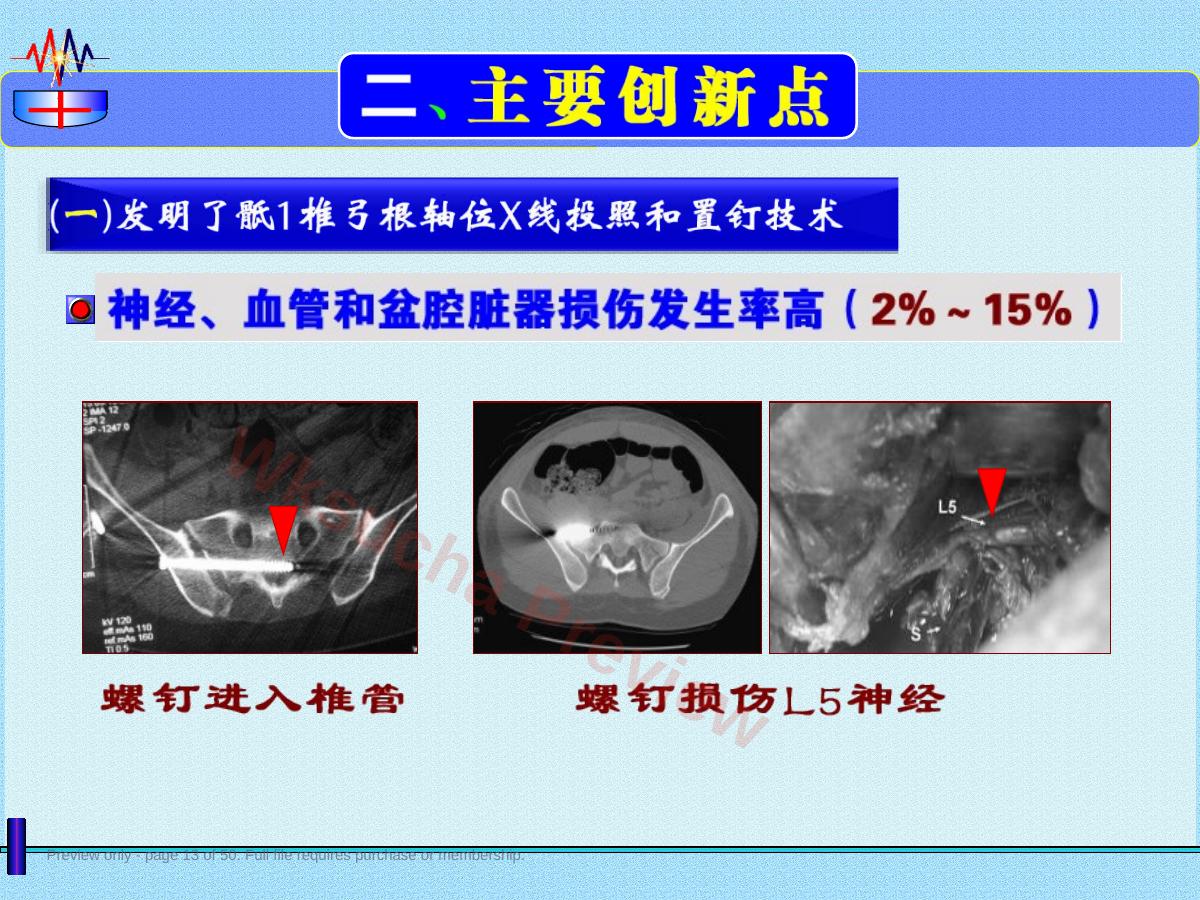 预览第 13 页