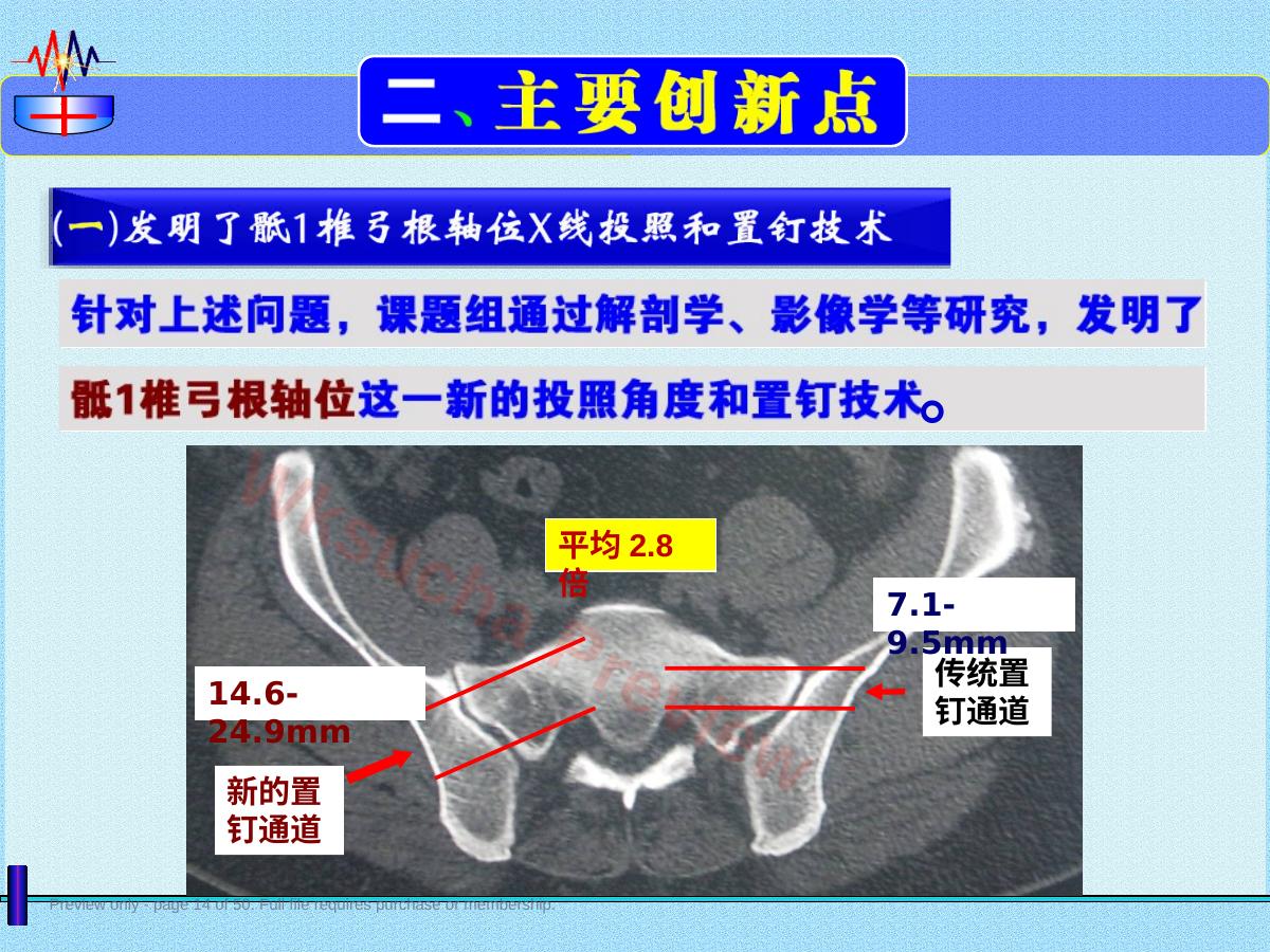预览第 14 页