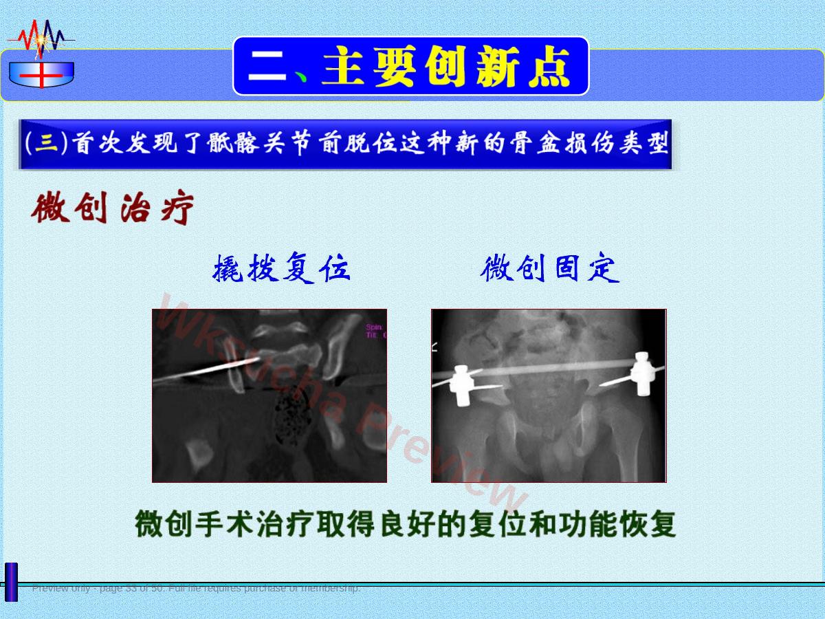 预览第 33 页