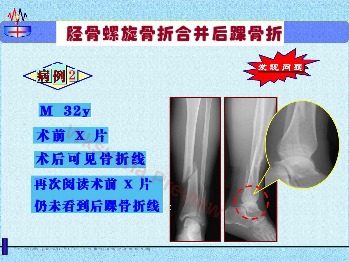 预览第 48 页