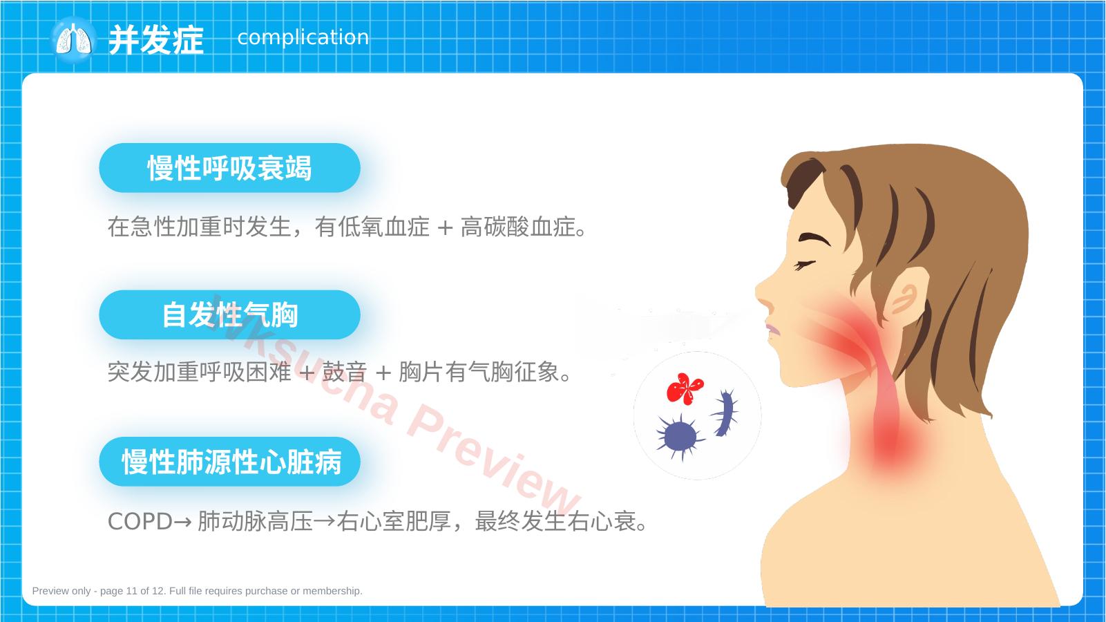 预览第 11 页