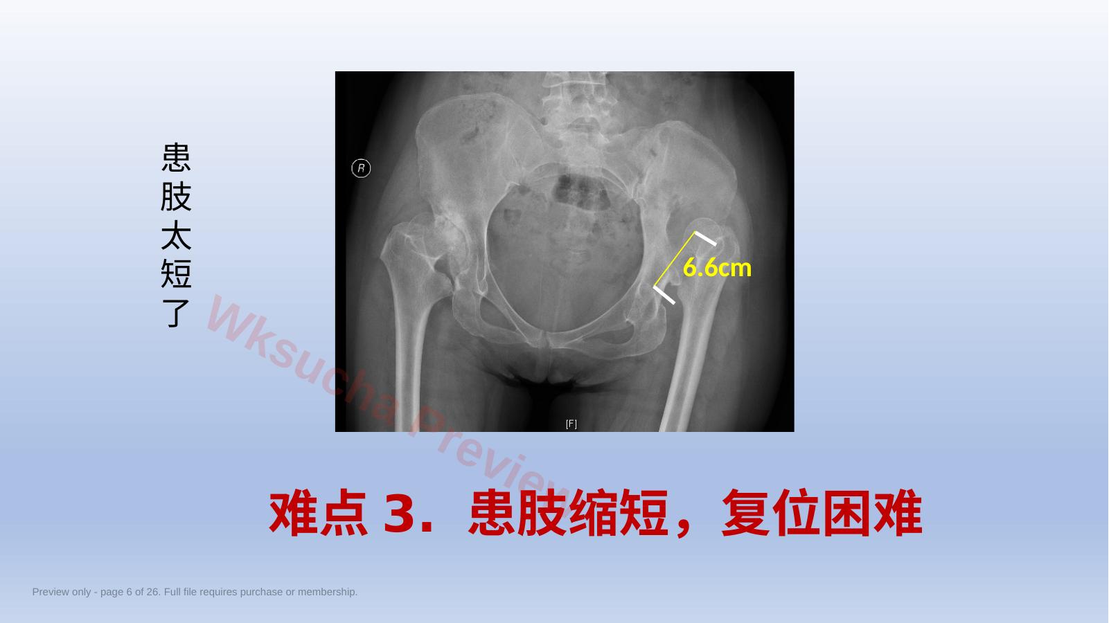 预览第 6 页
