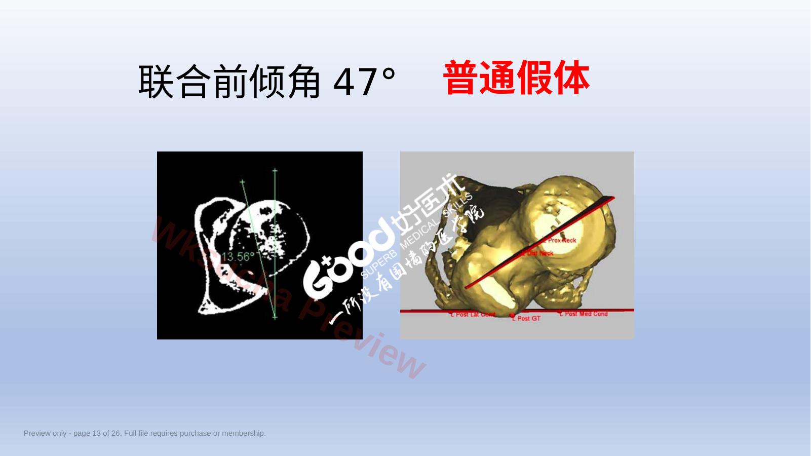 预览第 13 页