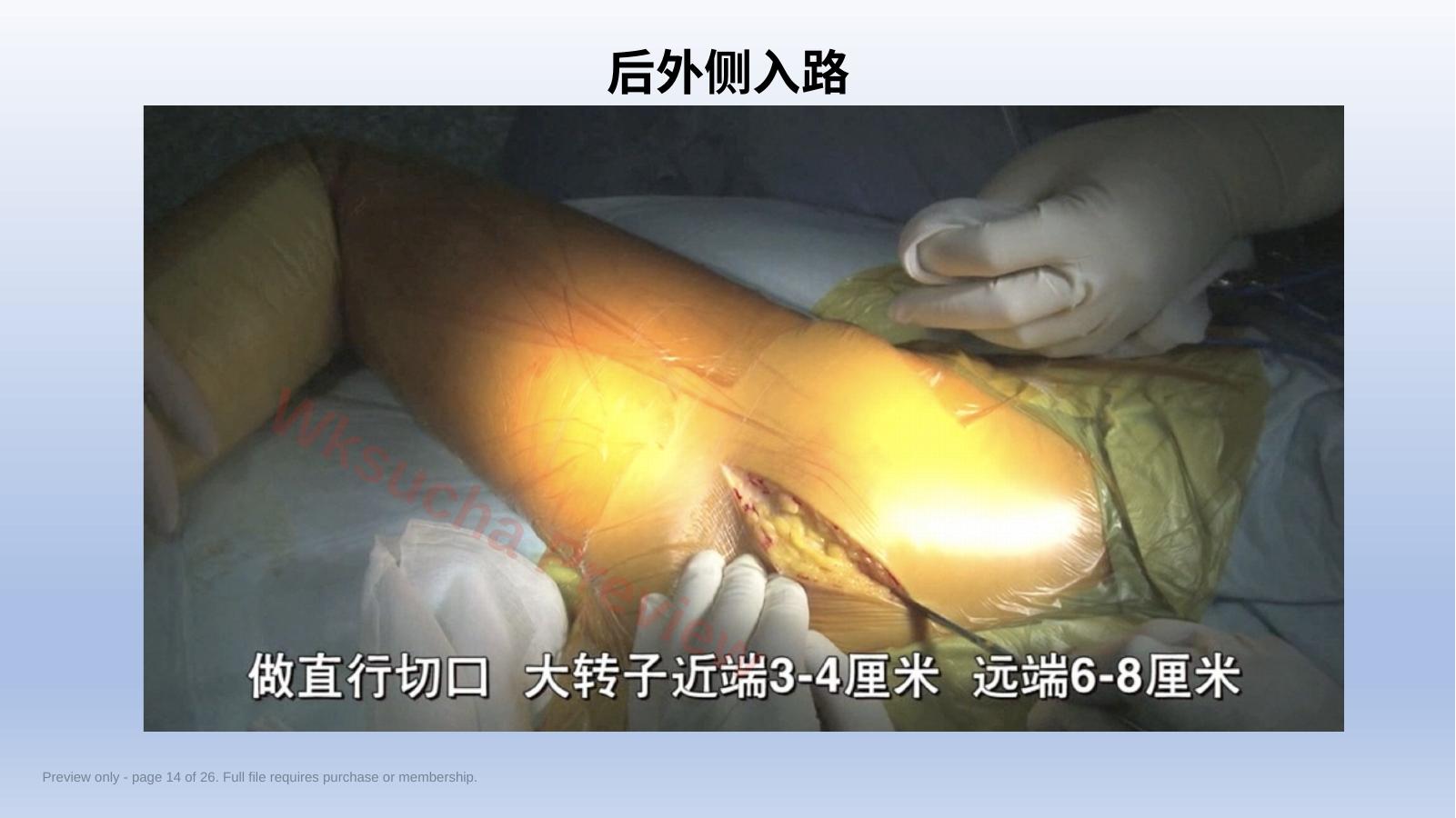 预览第 14 页