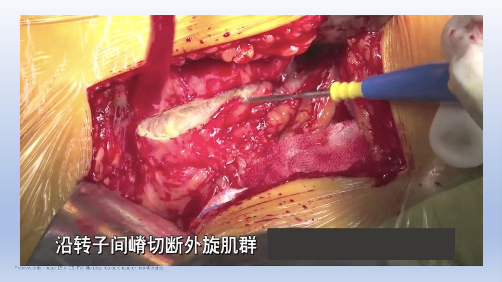 预览第 15 页