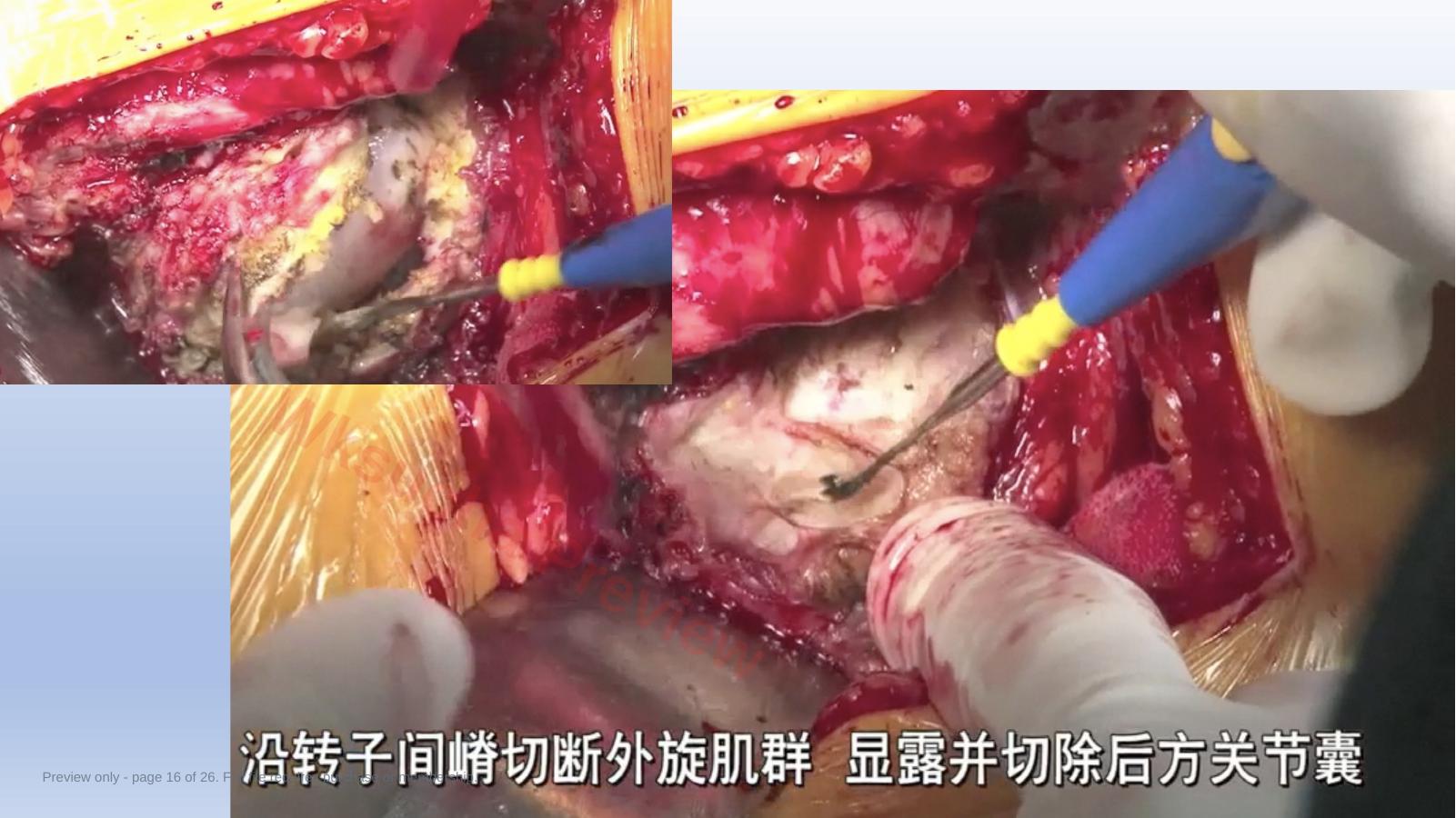 预览第 16 页
